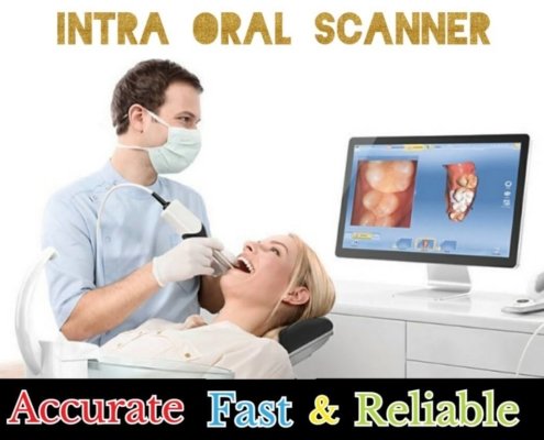 intra oral scanner